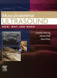 Cover image: Musculoskeletal Ultrasound 1st edition 9780702081989