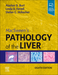 Cover image: MacSween's Pathology of the Liver 8th edition 9780702082283