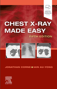 Cover image: Chest X-Ray Made Easy E-Book 5th edition 9780702082344