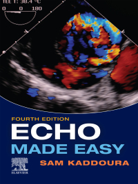 表紙画像: Echo Made Easy 4th edition 9780702083600