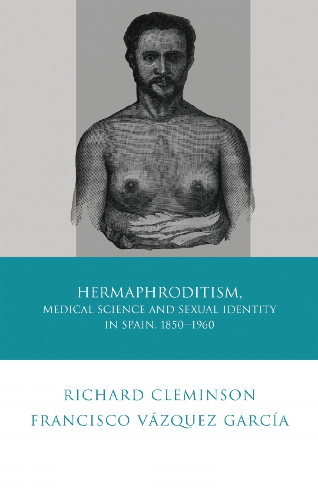 Hermaphroditism, Medical Science and Sexual Identity in Spain, 1850–1960 1st Edition