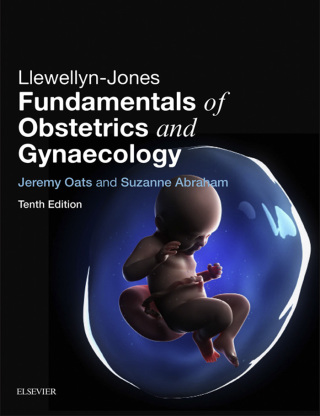 Cover image: Llewellyn-Jones Fundamentals of Obstetrics and Gynaecology E-Book 10th edition 9780702060656
