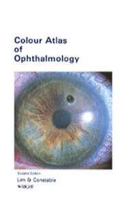 صورة الغلاف: Colour Atlas of Ophthalmology 2nd edition 9780723609476