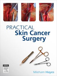 صورة الغلاف: Practical Skin Cancer Surgery 1st edition 9780729539326