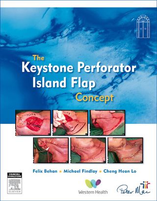 Cover image: The Keystone Perforator Island Flap Concept 1st edition 9780729539715