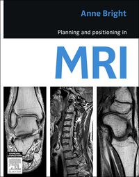 Cover image: Planning and Positioning in MRI 1st edition 9780729539852