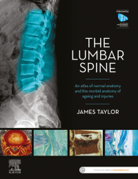 Cover image: The Lumbar Spine 1st edition 9780729543132