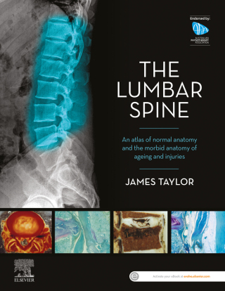 表紙画像: The Lumbar Spine 1st edition 9780729543132