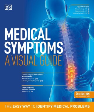 Cover image: Medical Symptoms: A Visual Guide, 2nd Edition 9780744051650