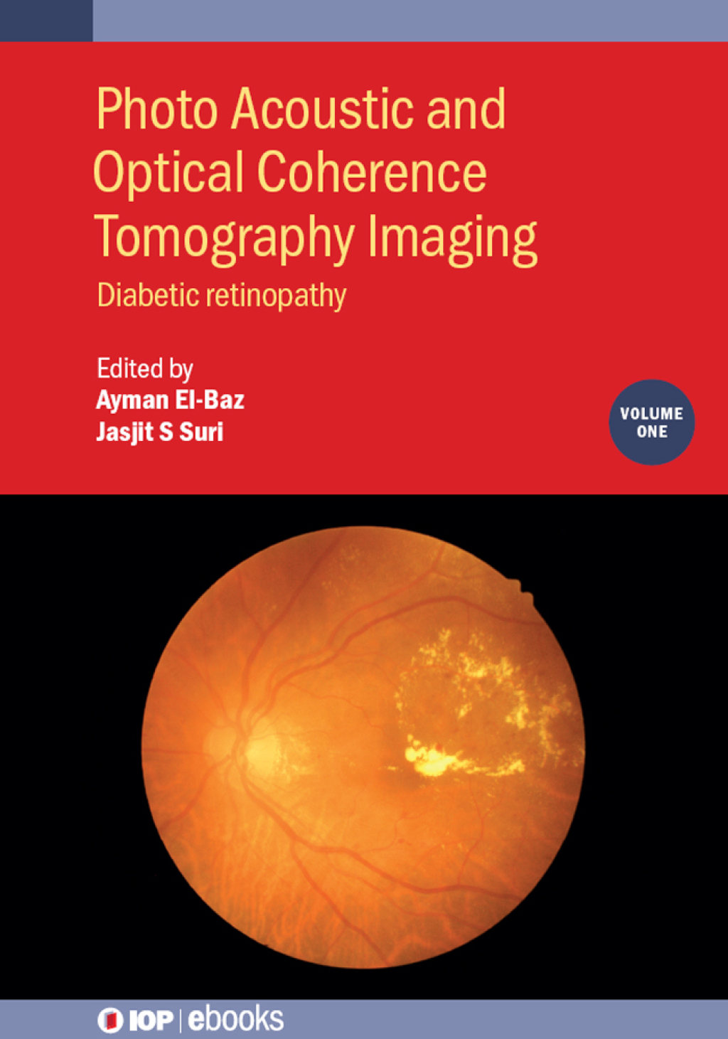 Photo Acoustic and Optical Coherence Tomography Imaging, Volume 1 Diabetic retinopathy