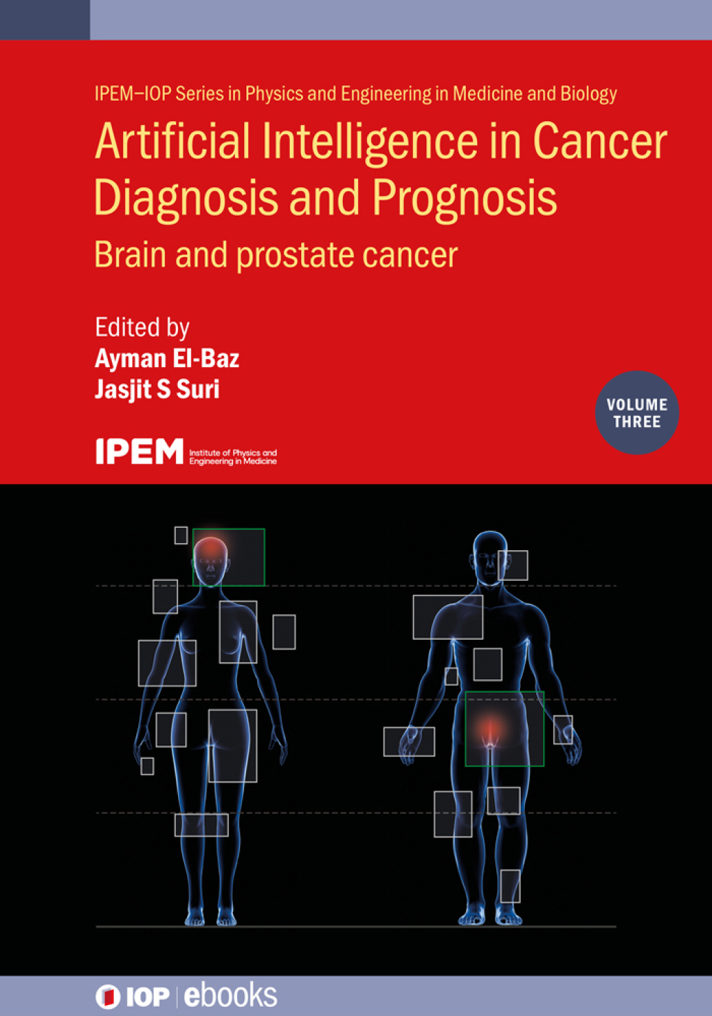 Artificial Intelligence in Cancer Diagnosis and Prognosis, Volume 3 Brain and prostate cancer