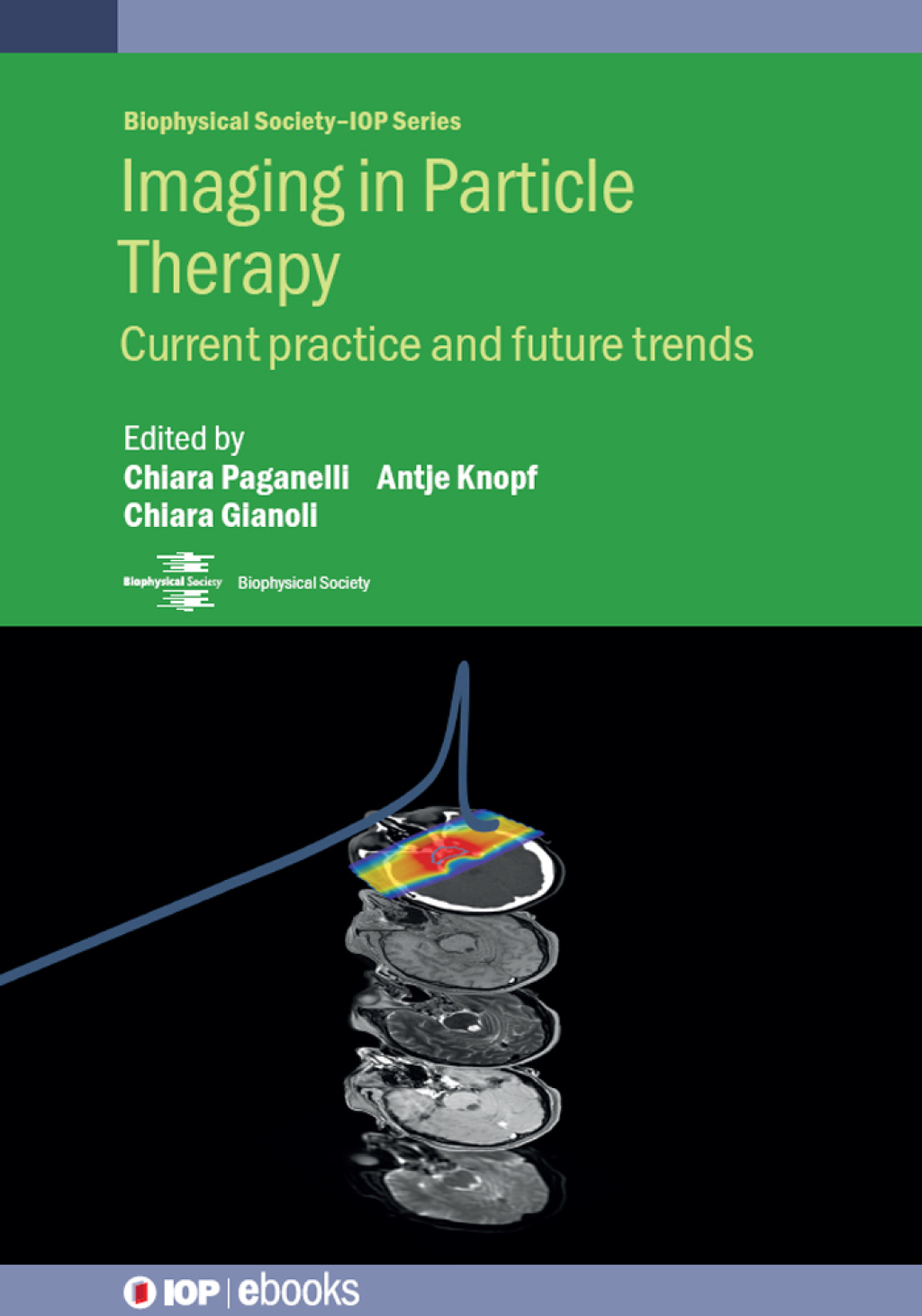 Imaging in Particle Therapy Current practice and future trends