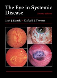 صورة الغلاف: The Eye in Systemic Disease 2nd edition 9780750610247