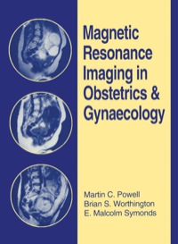 Cover image: Magnetic Resonance Imaging in Obstetrics and Gynaecology 9780750613217