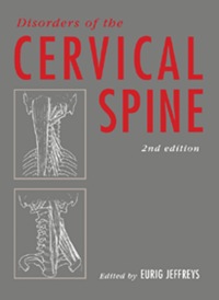 Titelbild: Disorders of the Cervical Spine 2nd edition 9780750613613