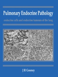 صورة الغلاف: Pulmonary Endocrine Pathology: Endocrine Cells and Endocrine Tumours of the Lung 9780750614405