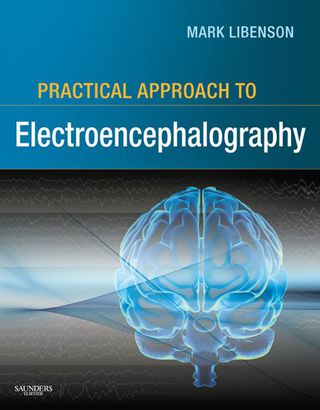 Cover image: Practical Approach to Electroencephalography 1st edition 9780750674782