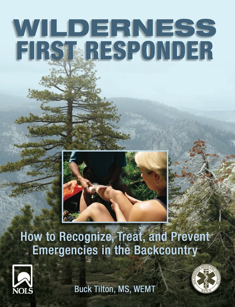 Wilderness First Responder: How to Recognize, Treat, and Prevent Emergencies in the Backcountry, 3rd Edition - FULL INSTANT DOWNLOAD | PDF DOCX EPUB