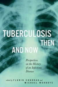 Cover image: Tuberculosis Then and Now 9780773536005