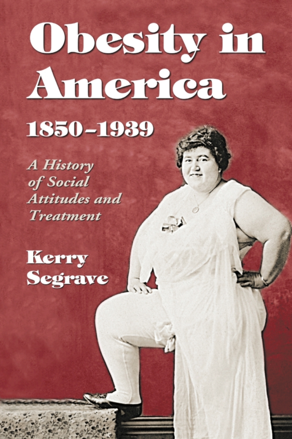 Obesity in America, 1850-1939 A History of Social Attitudes and Treatment