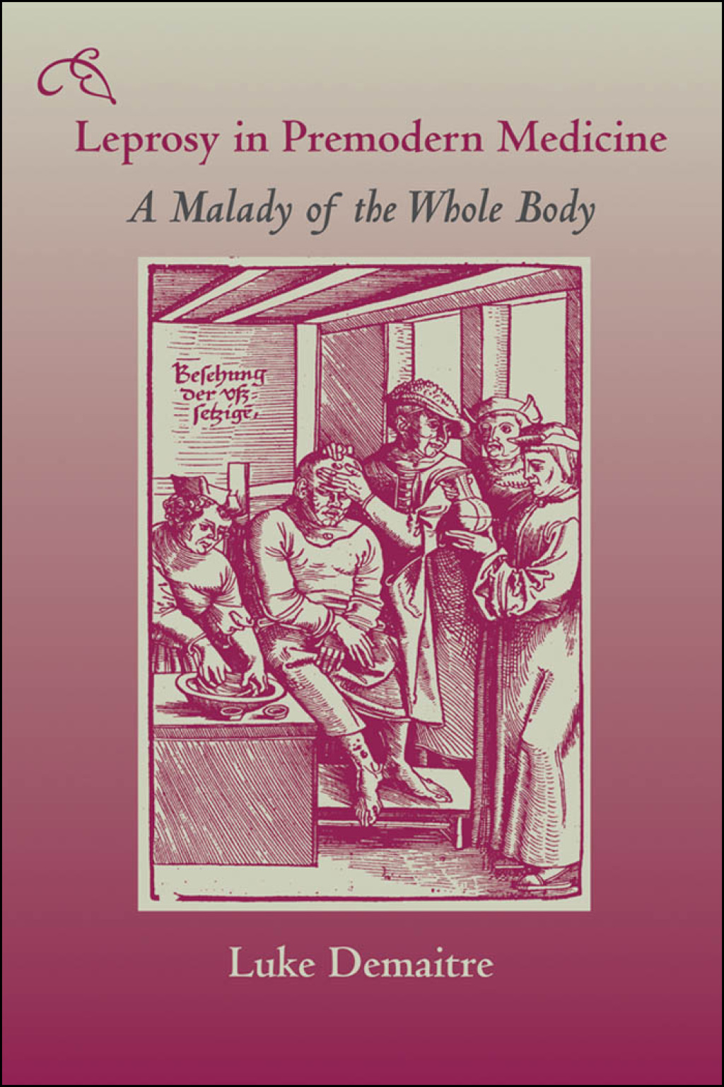 Leprosy in Premodern Medicine A Malady of the Whole Body