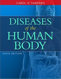 Omslagafbeelding: Diseases of the Human Body 6th edition 9780803644519