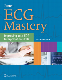 Cover image: ECG Mastery 2nd edition 9780803676930