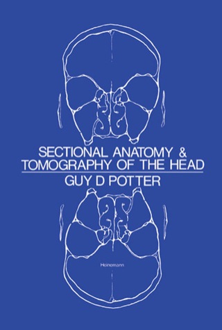 Imagen de portada: Sectional Anatomy and Tomography of the Head 9780808907008