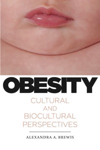 表紙画像: Obesity 9780813548906