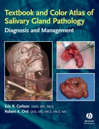 Cover image: Textbook and Color Atlas of Salivary Gland Pathology 1st edition 9780813802626