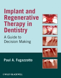 Cover image: Implant and Regenerative Therapy in Dentistry 1st edition 9780813829623