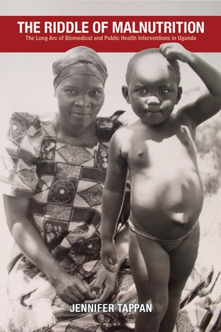 Cover image: The Riddle of Malnutrition 1st edition 9780821422465