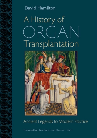 Cover image: A History of Organ Transplantation 9780822944133