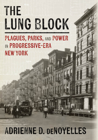 表紙画像: The Lung Block 9780822947868