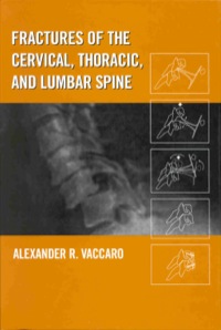 Omslagafbeelding: Fractures of the Cervical, Thoracic, and Lumbar Spine 1st edition 9780824707132