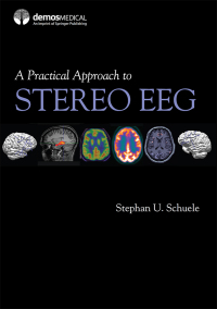 Cover image: A Practical Approach to Stereo EEG 1st edition 9780826136923