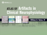 Titelbild: Atlas of Artifacts in Clinical Neurophysiology 1st edition 9780826169341