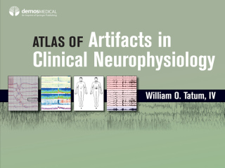 Cover image: Atlas of Artifacts in Clinical Neurophysiology 1st edition 9780826169341
