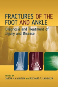 Titelbild: Fractures of the Foot and Ankle 1st edition 9780824759162