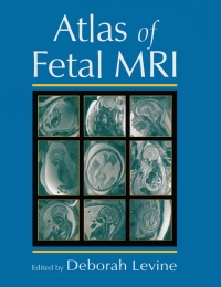 صورة الغلاف: Atlas of Fetal MRI 1st edition 9780824725488