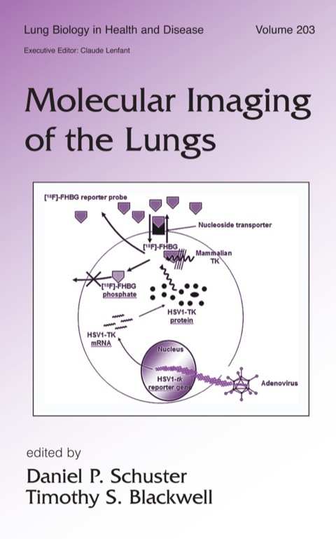 Molecular Imaging of the Lungs, 1st Edition - FULL INSTANT DOWNLOAD | PDF DOCX EPUB