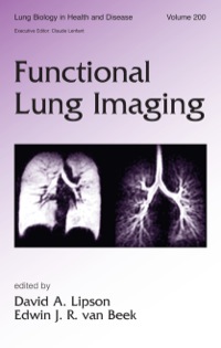 Cover image: Functional Lung Imaging 1st edition 9780824754273
