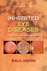 Cover image: Inherited Eye Diseases 2nd edition 9781574448399