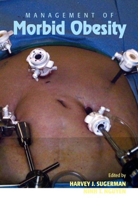 Management of Morbid Obesity, 1st Edition - FULL INSTANT DOWNLOAD | PDF DOCX EPUB
