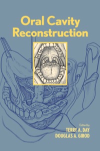Cover image: Oral Cavity Reconstruction 1st edition 9781574448924