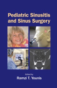 Cover image: Pediatric Sinusitis and Sinus Surgery 1st edition 9780824728816