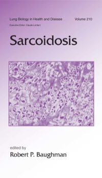 Imagen de portada: Sarcoidosis 1st edition 9780824759261