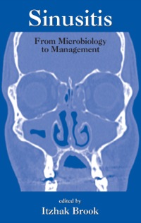 Cover image: Sinusitis 1st edition 9780367392154