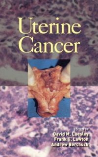 Imagen de portada: Uterine Cancer 1st edition 9780824759513