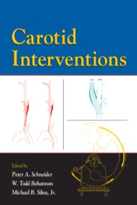 Cover image: Carotid Interventions 1st edition 9780367454333